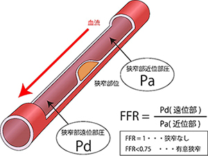 FFRの写真